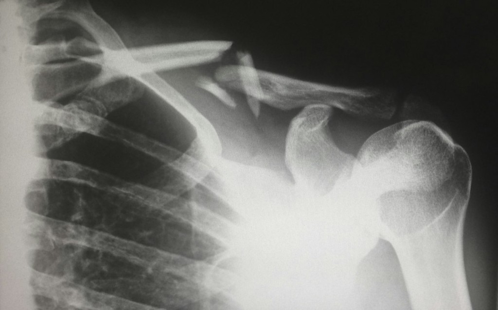 Radiografia médica — Técnico em Radiologia